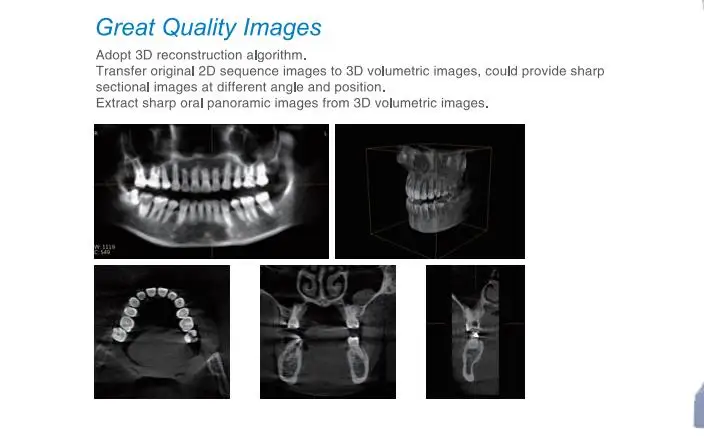 Рисунок 3 - YYHC больничное рентгеновское оборудование