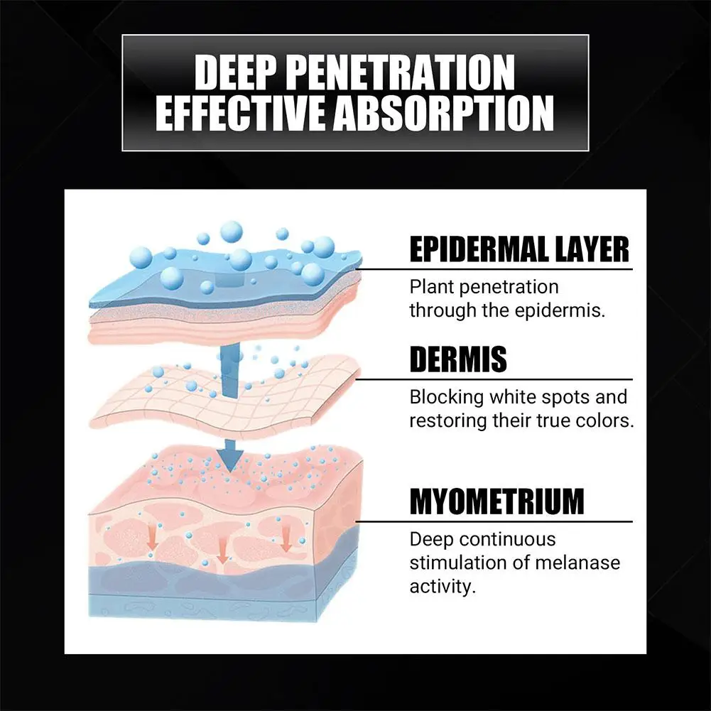 Рисунок 4 - Спрей Vitiligo увлажняющий для кожи