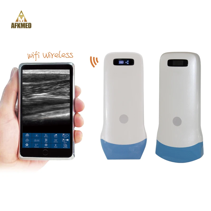Professional Portable Doppler Ultrasound Handheld Device Color Scan Systems Handheld Ultrasound Scanner