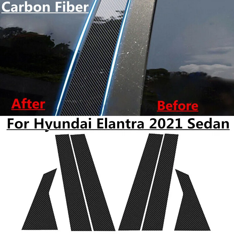 

6pcs/set Carbon Fiber Window Pillar Post Door Trim Cover For Hyundai Elantra 2021 Sedan