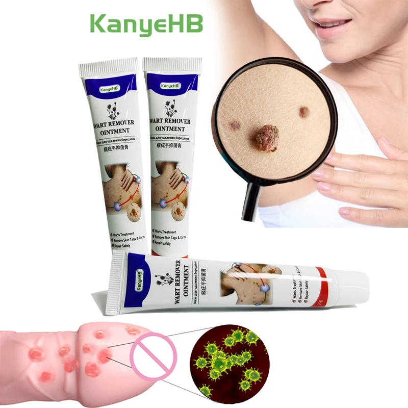 

1/2/3PCS Warts Remover Antibacterial Ointment Wart Treatment Cream Skin Tag Remover Genital Herpes Papillomas Treatment Ointment