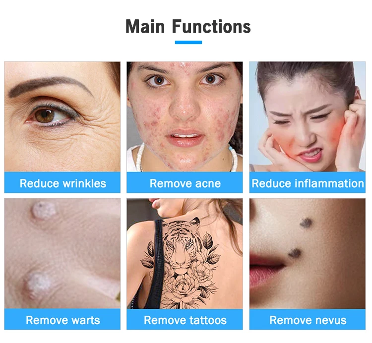 Новейшая 2 в 1 озоновая плазменная ручка для лифтинга лица и глаз Fibroblast Pen Skin Mole Dark