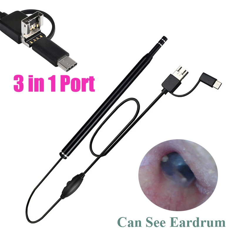 Herramienta médica de limpieza de oídos, endoscopio de limpieza de oído con USB, cuchara de cera de oído Visual HD, otoscopio con Mini bolígrafo de cámara