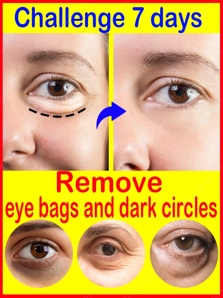 

Eye Cream Dark Circles And Bag Removal For Anti Bags Eyes