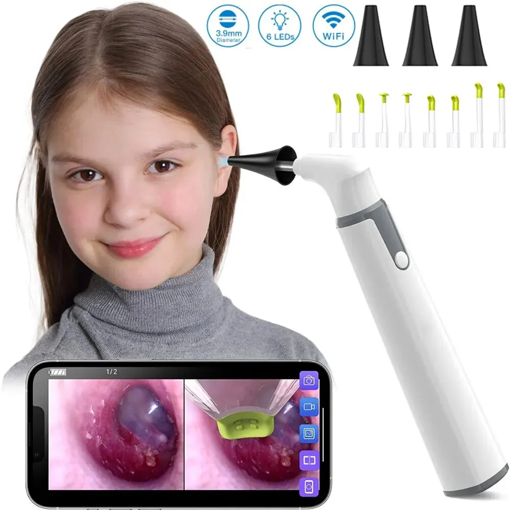 Ear Camera Endoscope 3.9mm Portable Wireless Otoscope 720P HD WiFi Ear Scope with 6 LED for Kids Adults Support Android iPhone Ear Camera Endoscope 3.9mm Portable Wireless Otoscope 720P HD WiFi Ear Scope with 6 LED for Kids Adults Support Android iPhone