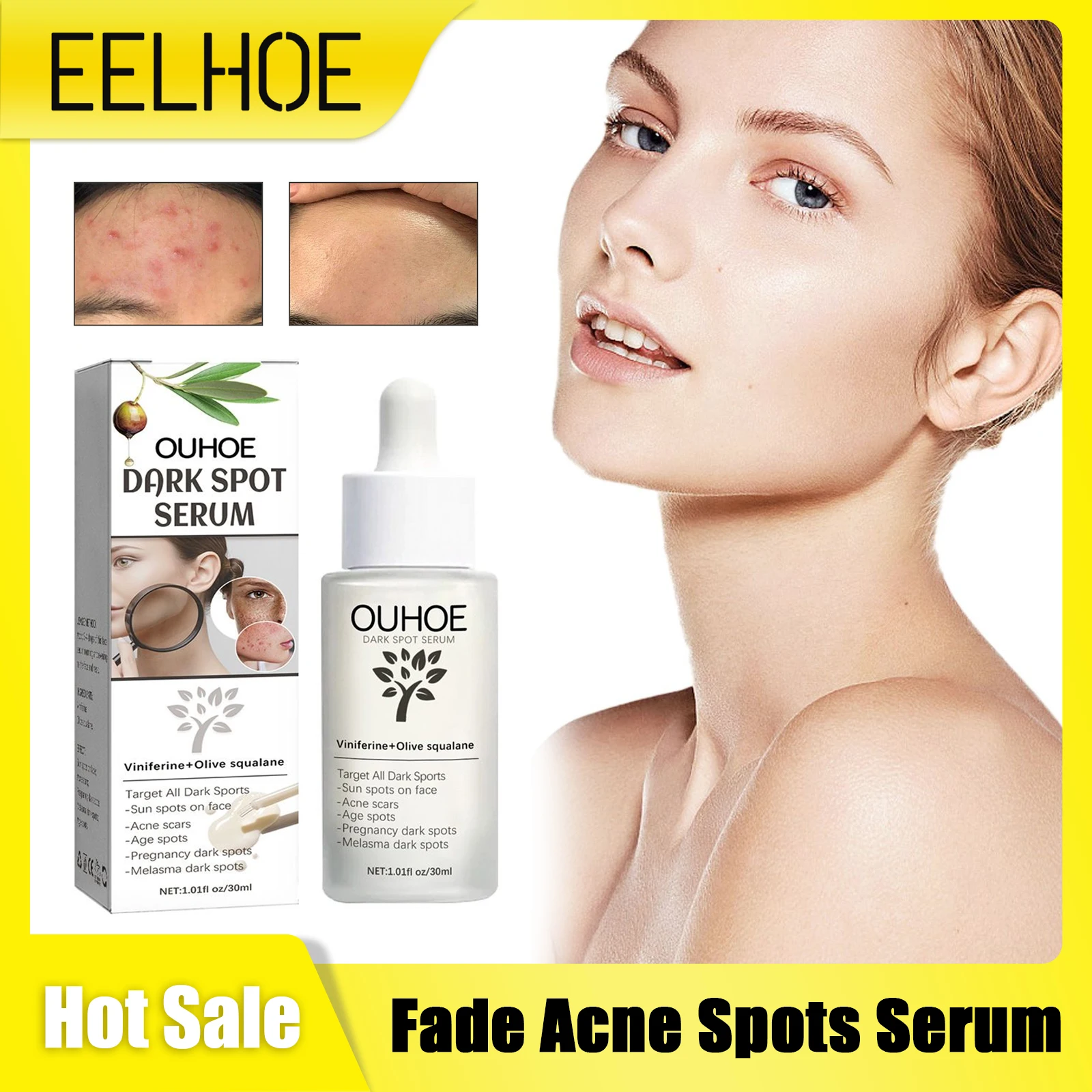 

Effective Fade Acne Spots Serum Pimple Removal Brighten Skin Tone Pores Shrink Oil Control Moisturizing Acne Treatment Essence