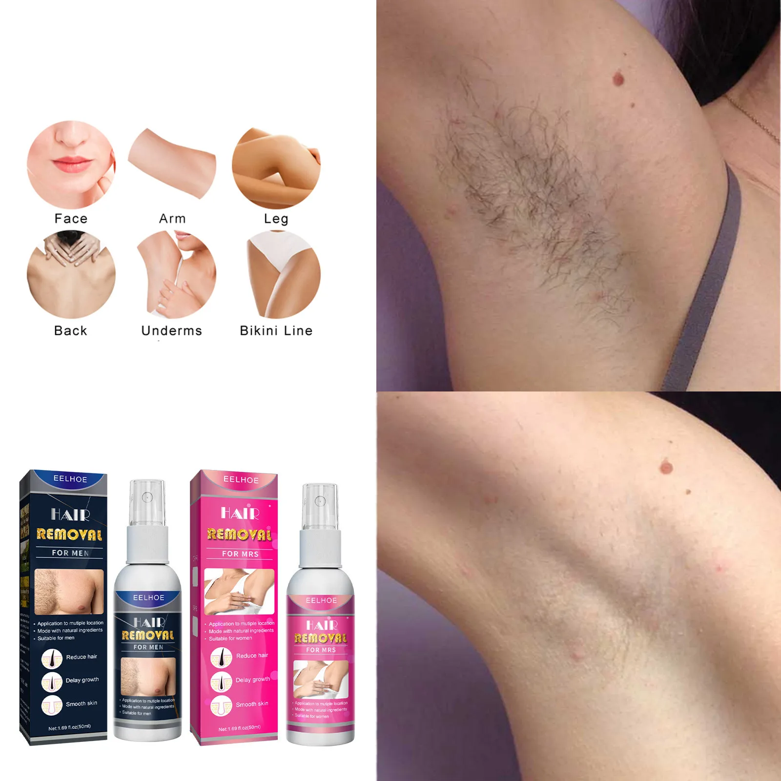 Hair Removal Spray For Men Women Legs Hands Arms Underarms Gentle Hair Removal Non Irritating Moisturizing Depilatory Spray