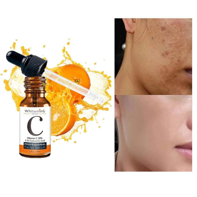 

Vitamin C Face Serum Whiten Brighten Moisturizing Face Improve Rough Skin Lighten Spots Hyaluronic Acid Facial Skin Care Essence