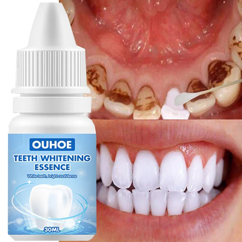 Teeth Whitening Essence Effectively Remove Plaque Stains Whiten Teeth Whitener Fresh Breath Bleaching Teeth Oral Hygiene Care