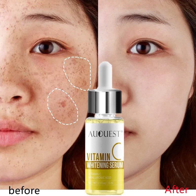 

Vitamin C Whitening Face Serum Lighten Dark Spots Brightening Remove Freckle Speckle Acne Scars Esence Repair Skin Care Products