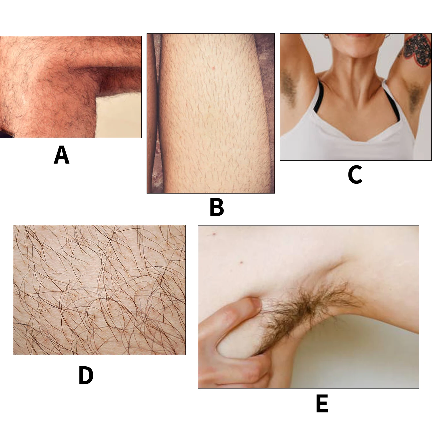 Рисунок 4 - Спрей для удаления волос