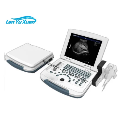 

Ultrasound Scanner China Wireless Usb Ultrasound Scanner 3d 4d Ultrasound Scanner