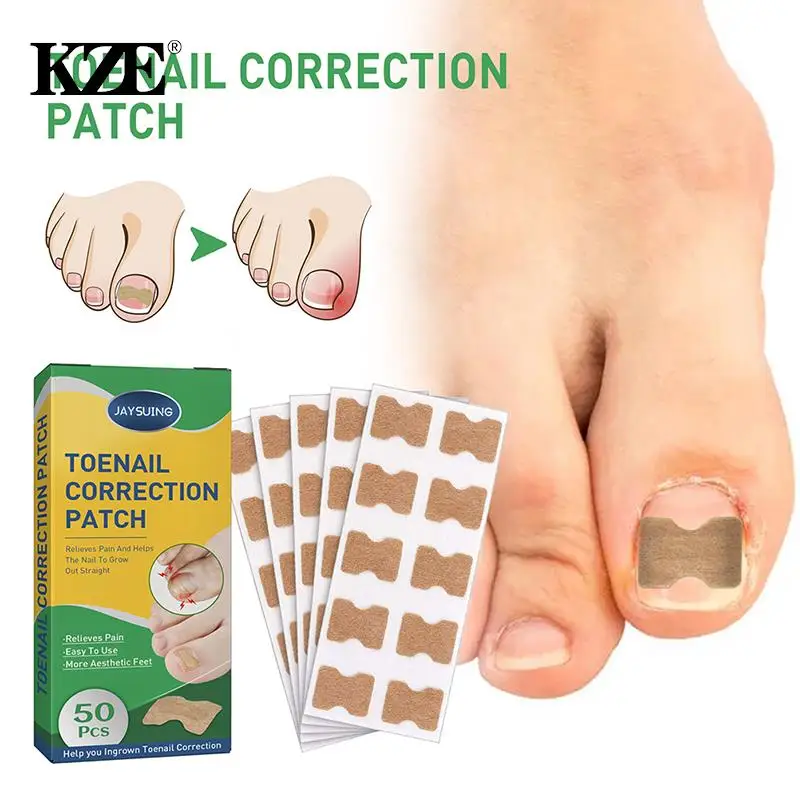

50pcs Nail Correction Stickers Ingrown Toenail Corrector Patches Paronychia Treatment Recover Corrector Pedicure Tools