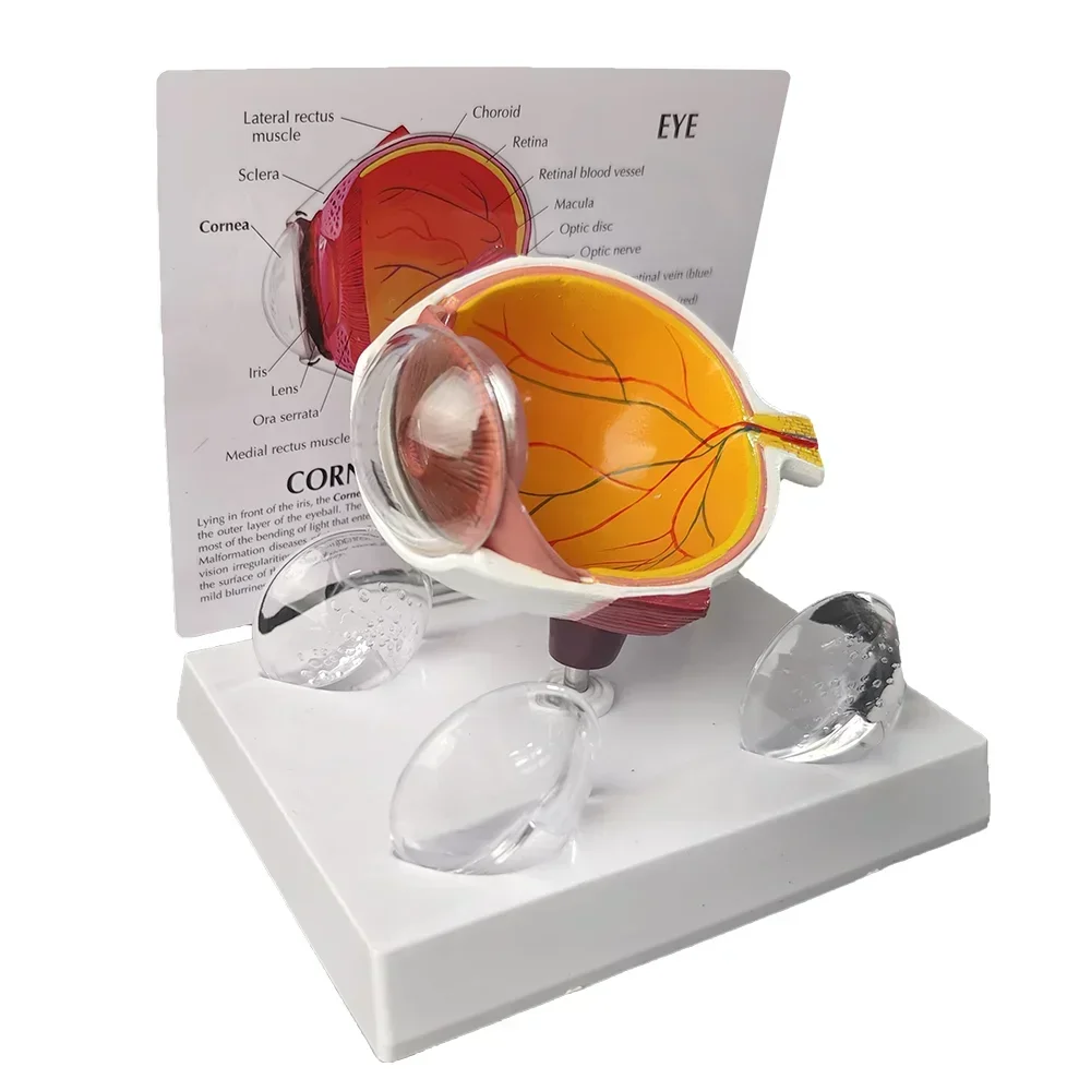 Медицинская Обучающая Модель Модельerous Eye Анатомия Человеческого Глаза