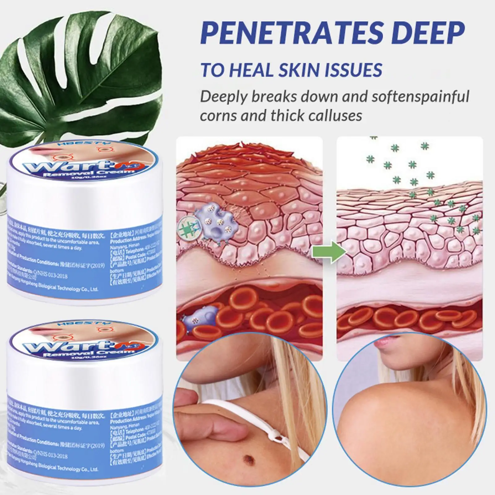 

10G Wart Remover Safe Painless Skin Tags Removal Ointment Fast Acting Remover Cream for Warts Moles Corn for All Skins Z7V9