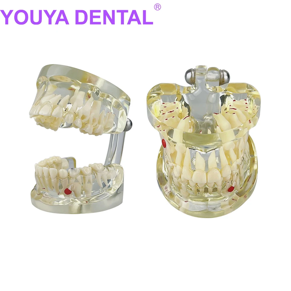 

Child Deciduous Teeth Pathology Tooth Model for Dentist Student Practice Training Study Model Dentistry Products Dentistry Tool