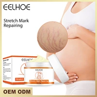 eelhoe pregnant lines repair pregnant women tighten and relax postpartum care growth lines improve and fade lines skin cream