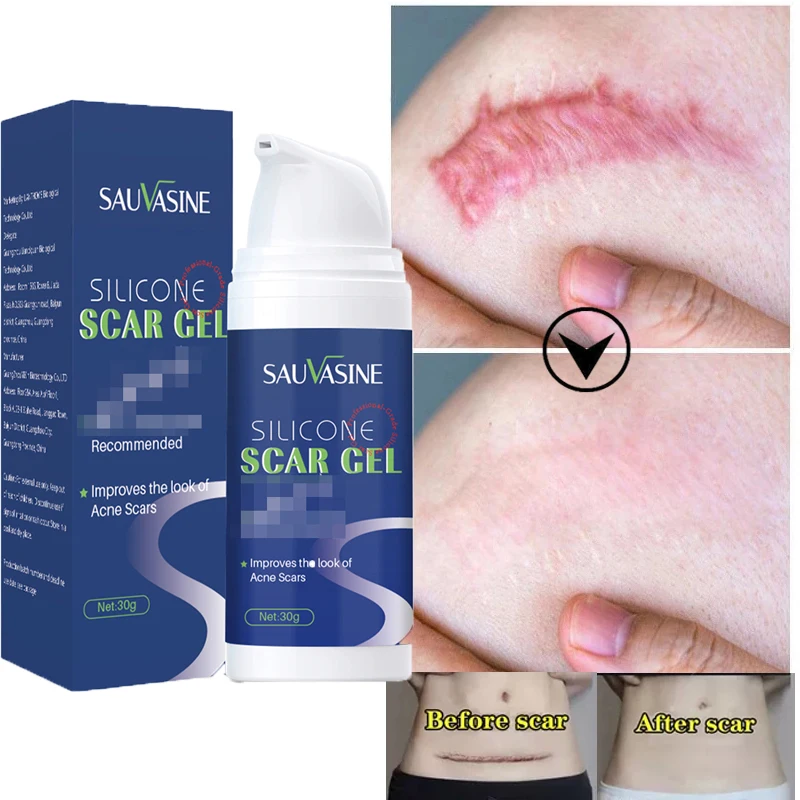 

Acne Scar Removal Cream Remove Caesarean Section Scars Stretch Marks Surgical Scars Burn Repair Gel Smooth Moisturizer Skin Care