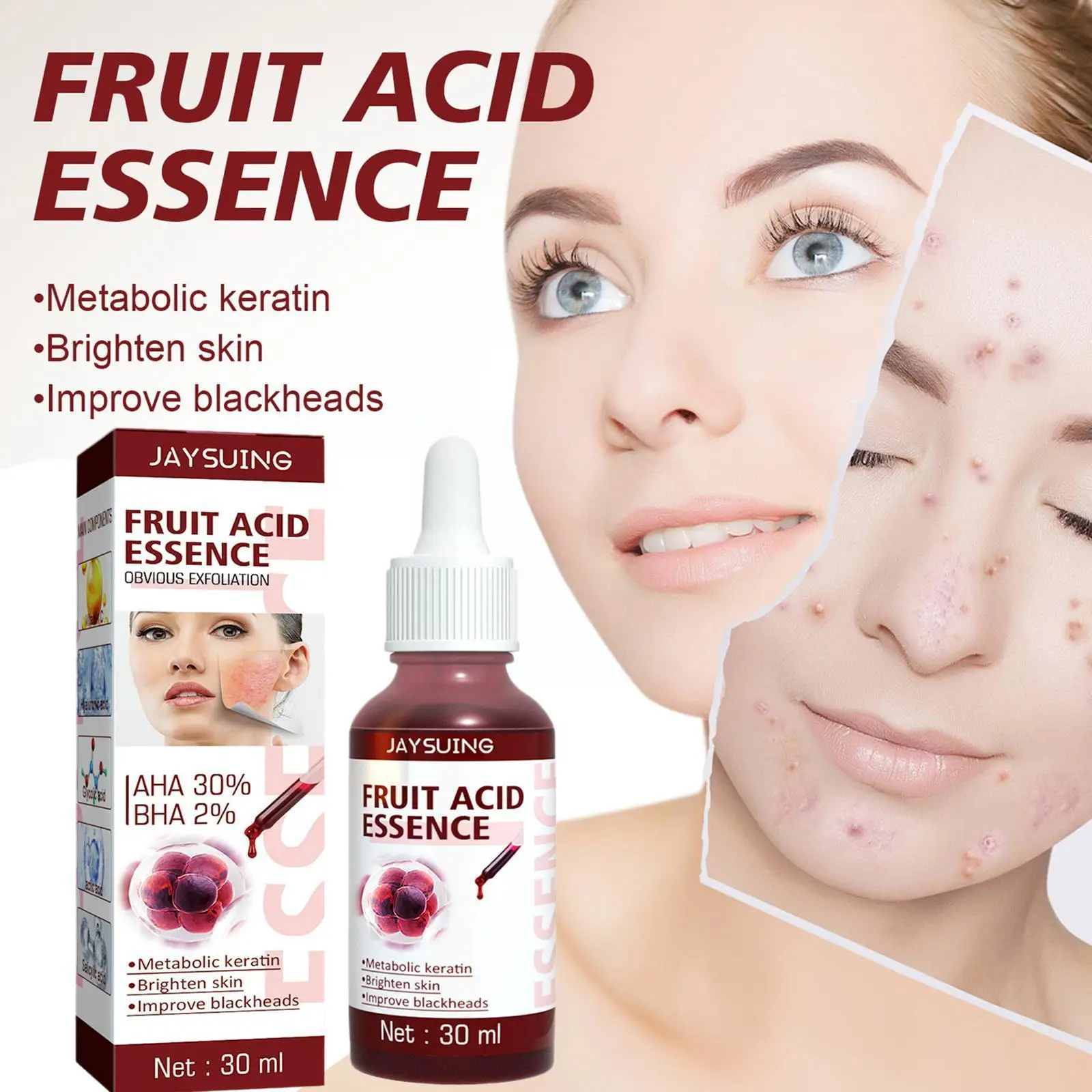 

Фруктовая кислота со склада, очищает поры, смягчает кутин, удаляет осветление, эссенция тонкого цвета, восстанавливает черные точки, линии к...