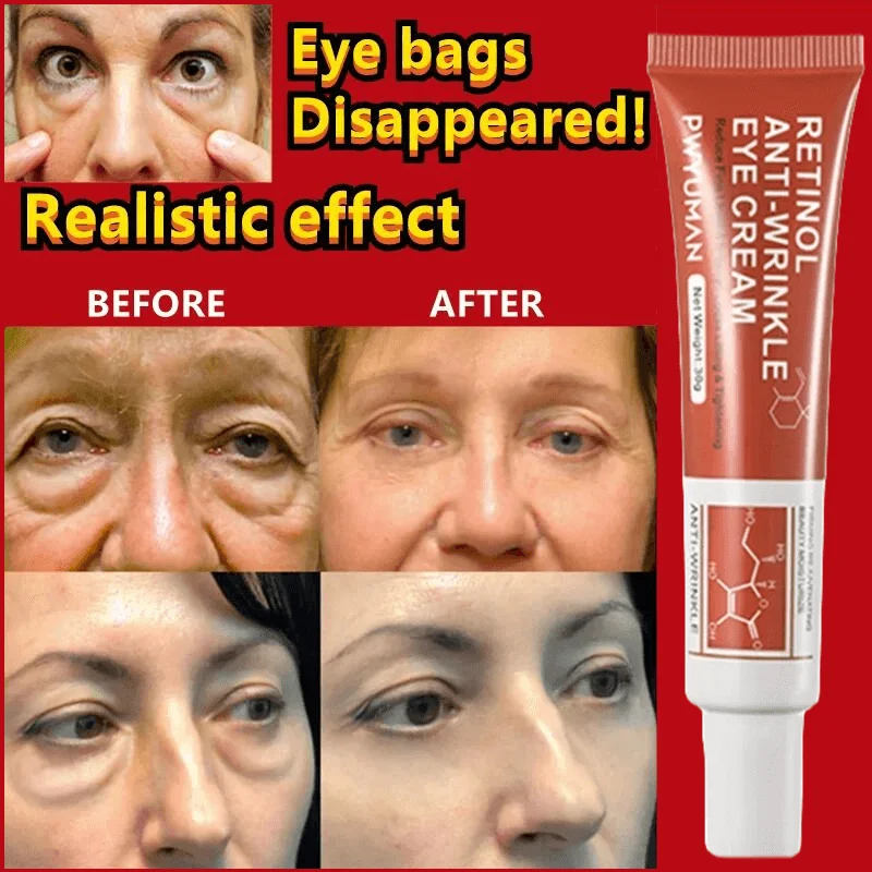 Крем для области вокруг глаз