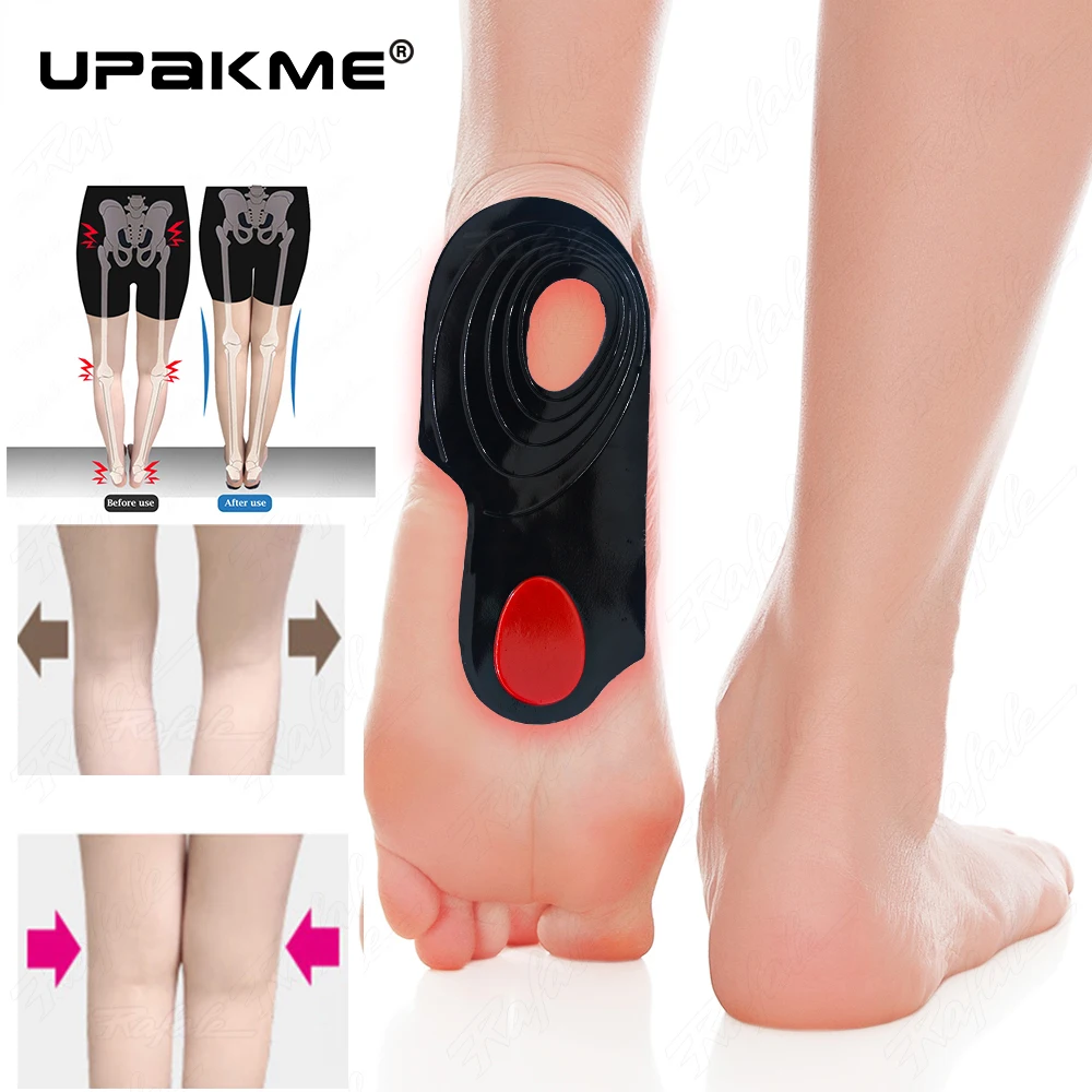 

UPAKME O/X Legs Correction Insole Orthopedic Inserts Arch Support Orthoses Pad Massaging Shoe Cushion Flat Foot Care Shoe Unisex