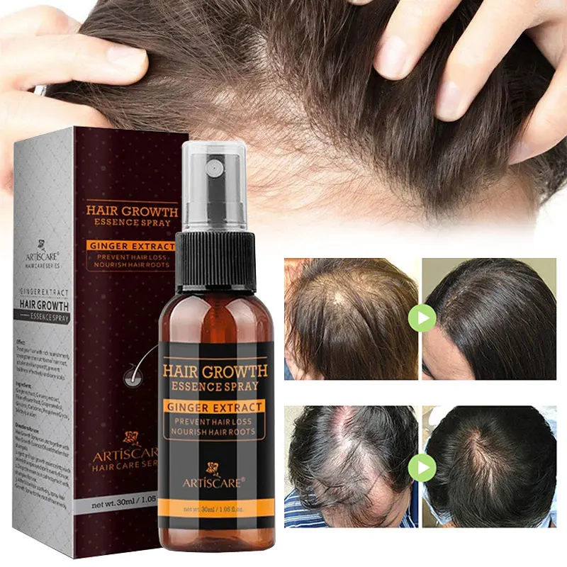 

Hair Growth Spray Nourishing Repair Damaged Dry Frizzy Anti Hair Loss Ginger Serum Scalp Healthy Treatment Regrowth Smooth 30ml