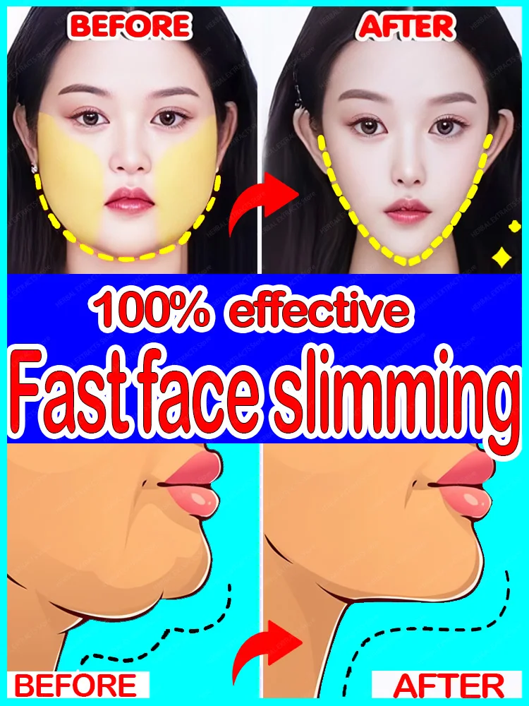 

V Shape Face Slimming Cream Remove Double Chin