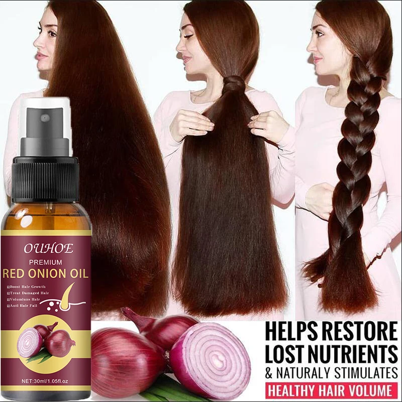 Onion Oil Hair Growth Spray Hair Loss Treatment Prevent Baldness Fast Grow Serum Nourish Scalp Repair Damaged Hair Care Products