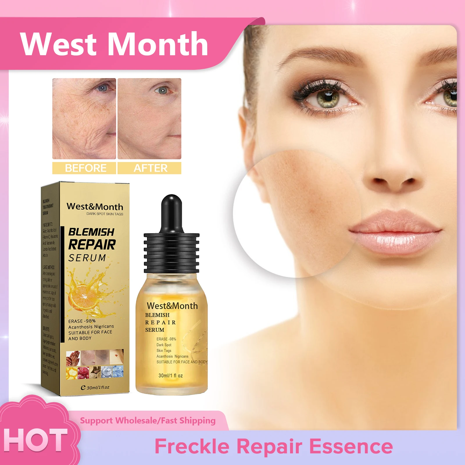 

Freckle Repair Essence Removal Facial Wrinkles Fine Lines Whitening Lighten Spots Anti Aging Bleaching Melanin Correcting Serum