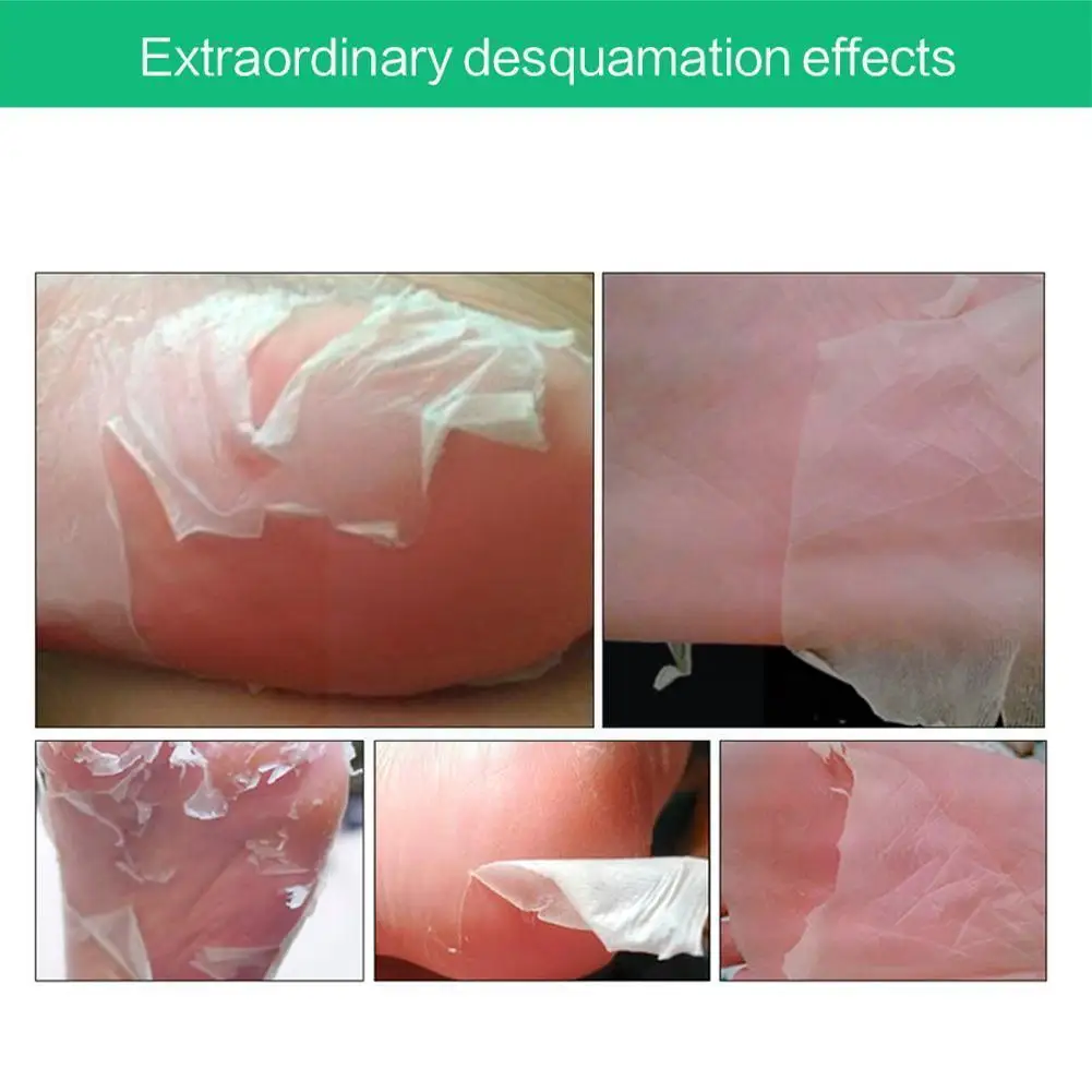 

1pair Aloe Vera Foot Exfoliating Foot Peel Dead Vera Callus Anti Removes Skin Aloe Heel Cracked Peeling Feet C0a0