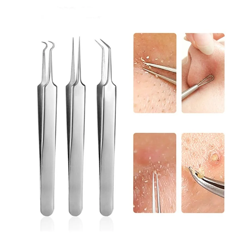 

3 Pcs/set Acne Needle Tweezers Blackhead Blemish Pimples Removal Pointed Bend Gib Head Face Care Tools Comedone Acne Extractor
