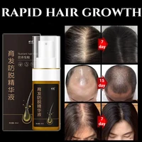 30ml hair growth anti falling essence nourishes hair roots to promote black hair oily hair growth and development hair loss