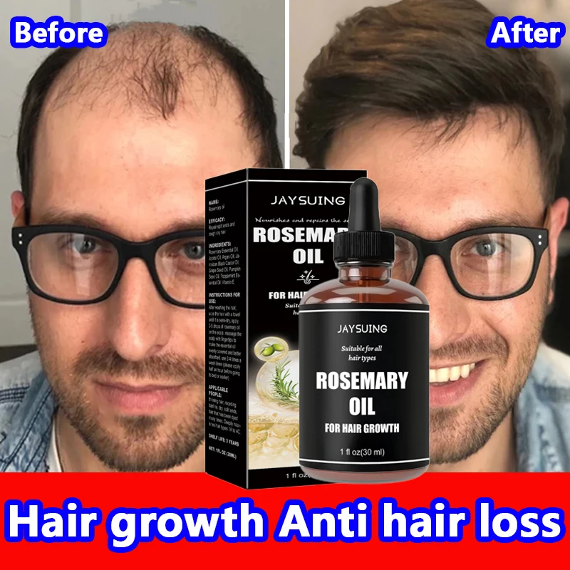 Rosemary Oil for Hair Growth Thick Eyebrow Eyelash Anti Hair Loss Treatment Nourishes Scalp Castor Oil Organic Ginger Skin Care