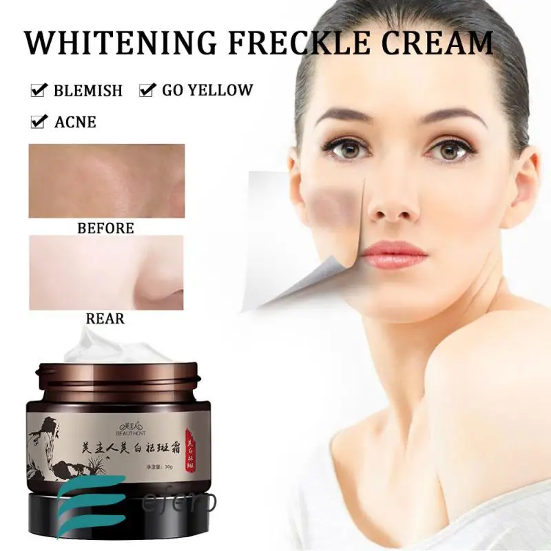 

Freckle Removal Whitening Cream 30g Strong Effects Whitening Anti Wrinkle Cream Freckle artifact Remove Acne Spots Face Care