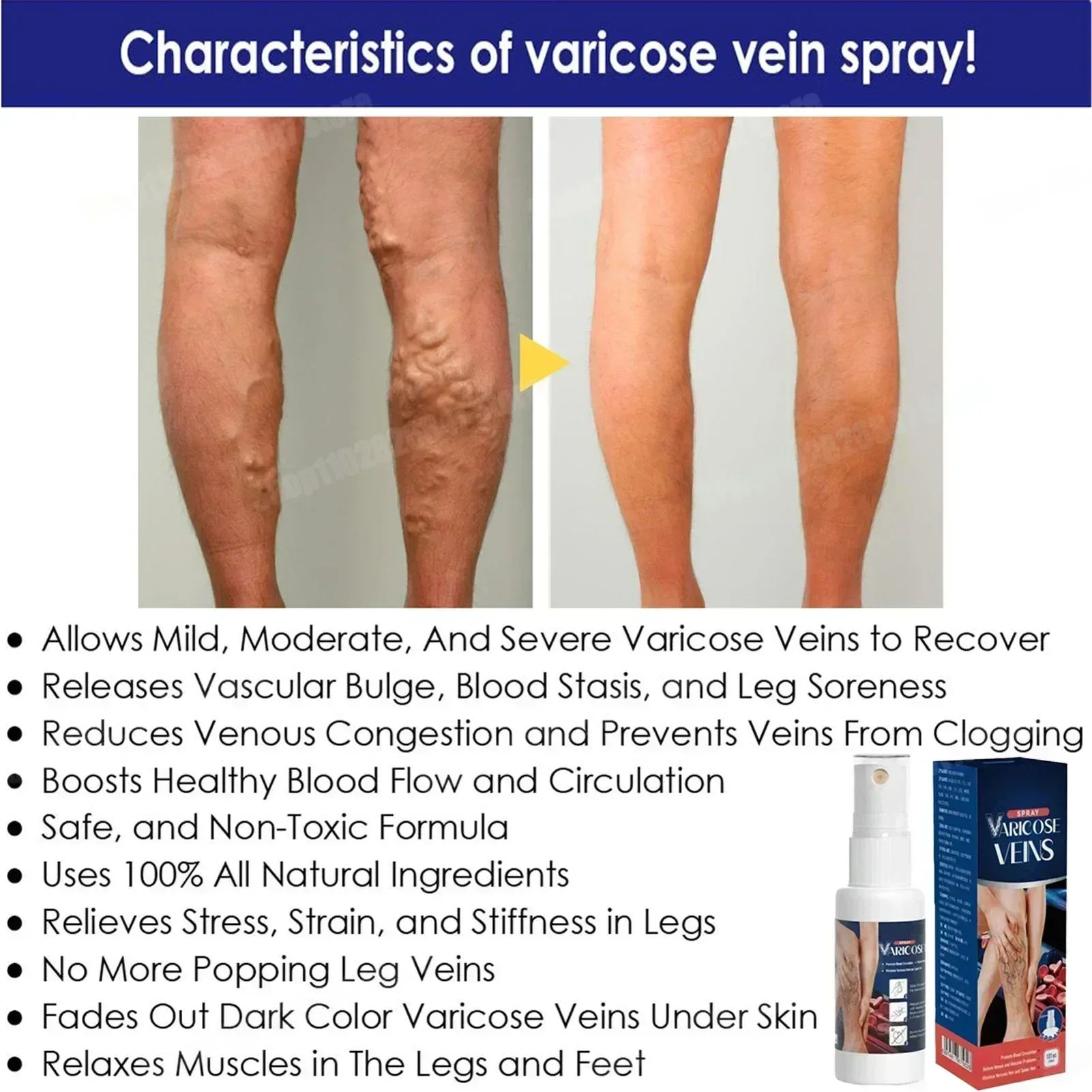 Надежный спрей для варикозного расширения вен натуральные травы успокаивающий с