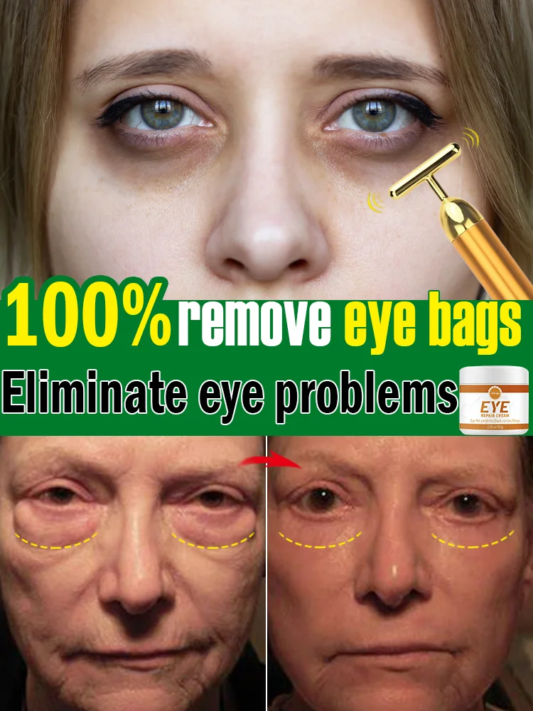 Электрический массажер для лица Вибрирующая ручка красоты глаз темных кругов