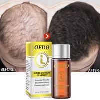 ginger hair growth essential oil anti hair loss stimulate hair follicle scalp treatment products fast grow thicker repair care