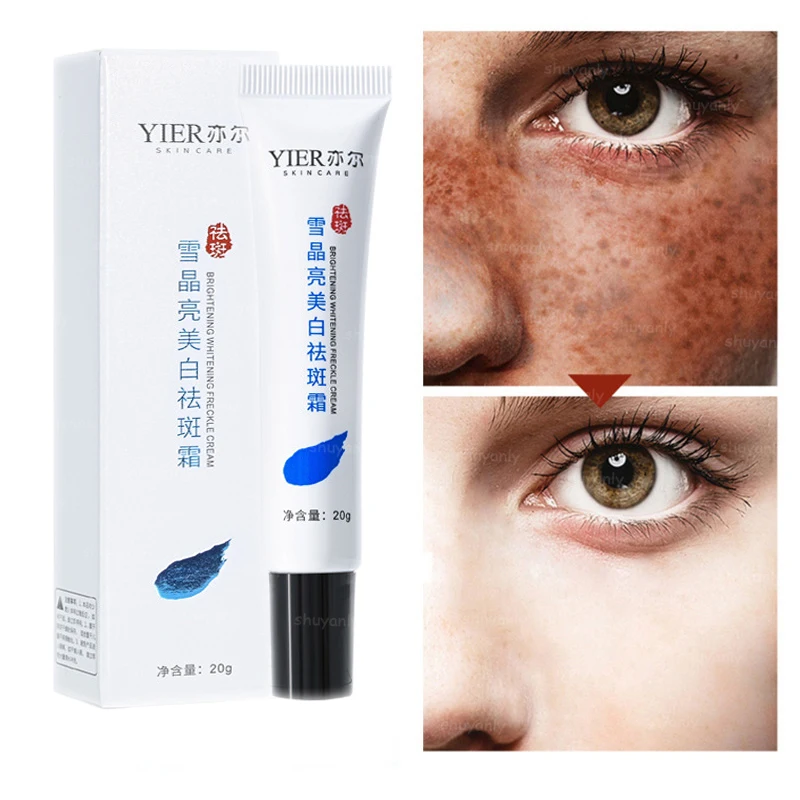 

Whitening Freckle Cream Remove Melasma Cream Remove Dark Spots Melanin Melasma Remover Brighten Skin Anti-Aging Skin Care