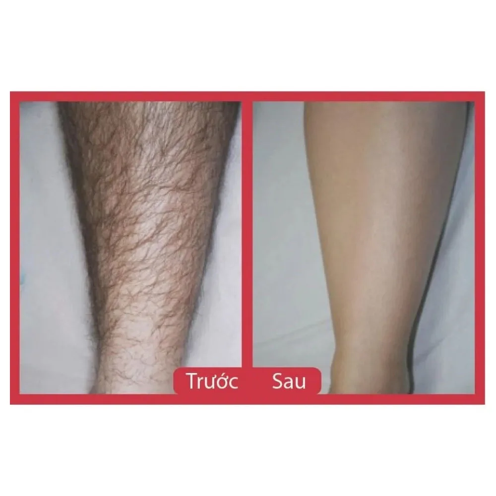 Kem Tay Long Tang сыворотка Cao Triet долгое безболезненное мягкое удаление волос для тела