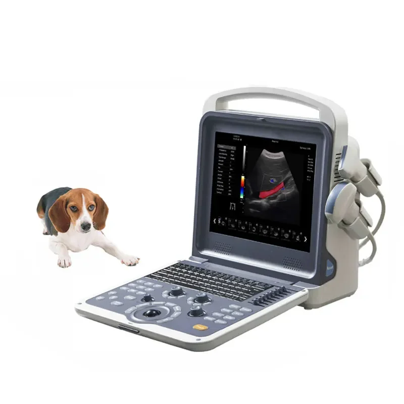 Рисунок 5 - Ультразвуковой Доплер для ноутбука