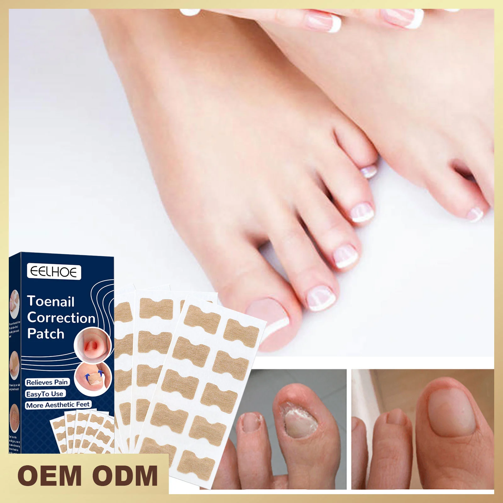

Nail Correction Stickers Ingrown Toenail Corrector Patches Waterproof Paronychia Treatment Recover Corrector Pedicure Tool 50pcs