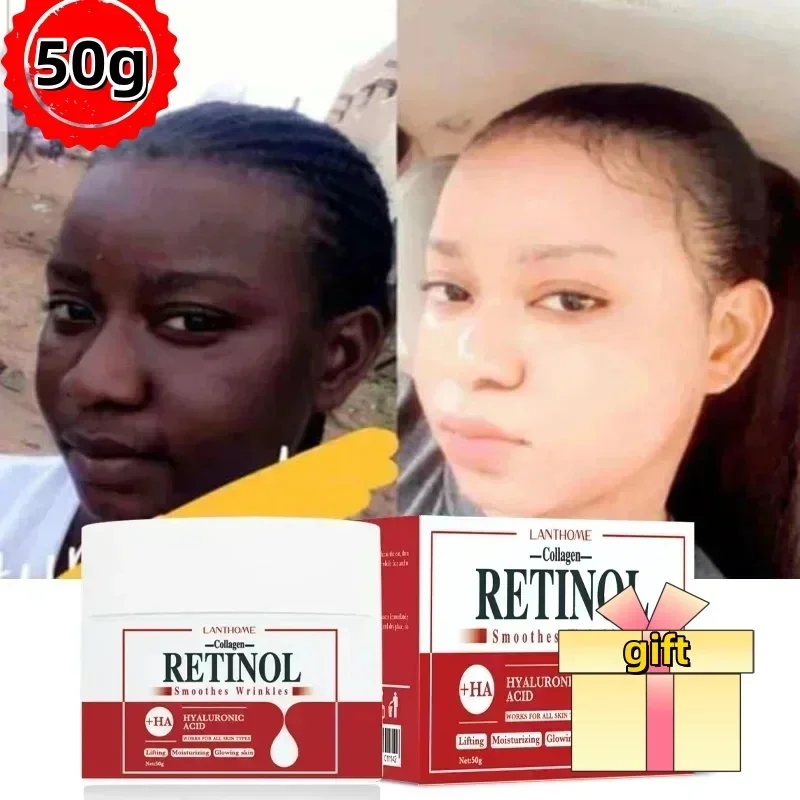 Отбеливающий крем для лица и тела ретинол коллаген гиалуроновая кислота 3 в 1