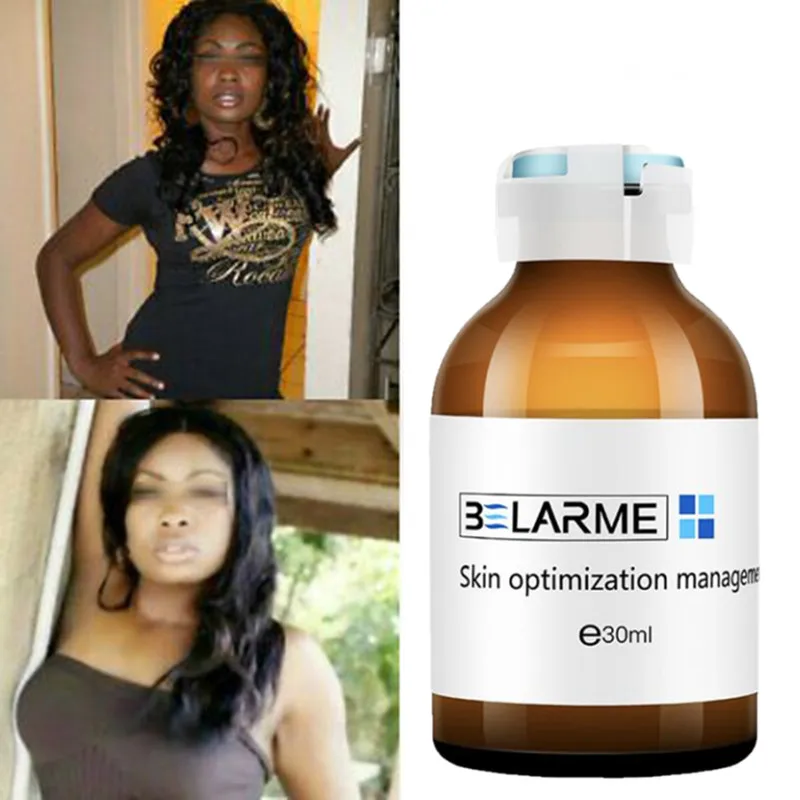 2% Ниацинамид + 0.3% глицирризиа отбеливание кожи осветление сыворотка крем для