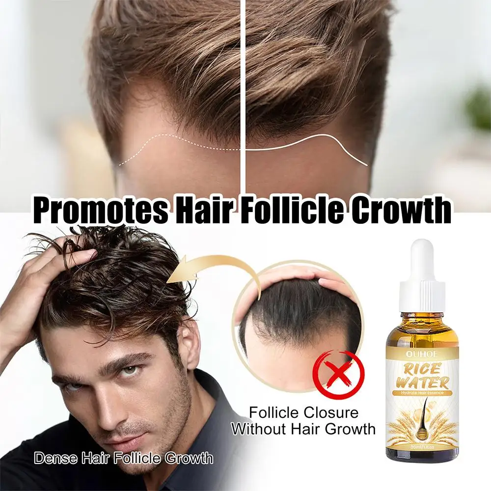 

Biotin Thickening Herbal Serum Rice Water Hydrate Hair Essence Ginger Hair Care Oil Promotes Stronger Hair For Women Men T0Z8