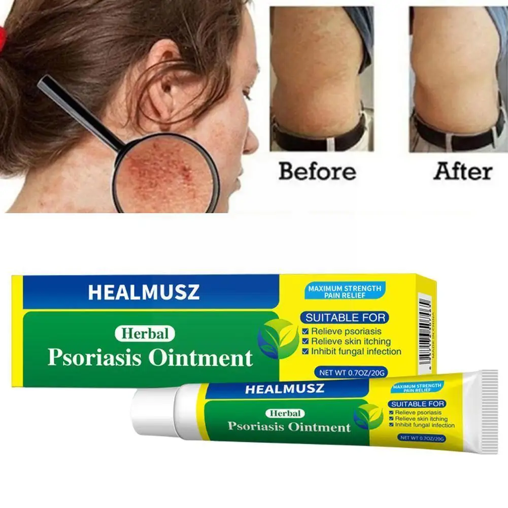 

Крем от псориаза и дерматита, антибактериальный крем против зуда, 20 г