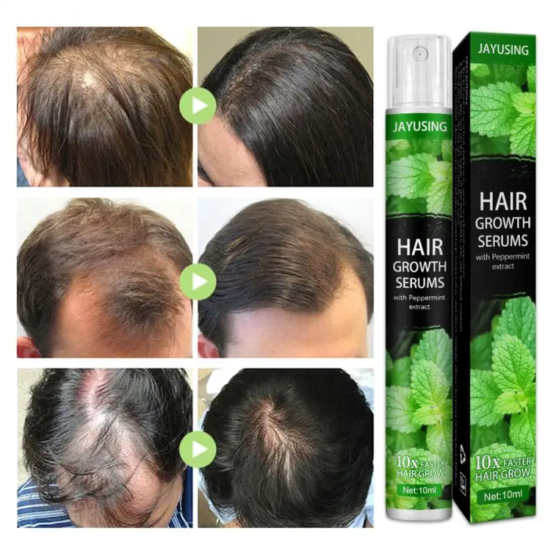 

10ml Mint Hair Tonic Hair Oil Hair Loss Treatment Fast Growing Nourishing And Hydrating Hair Care TSLM2 Dropshipping/Wholesale