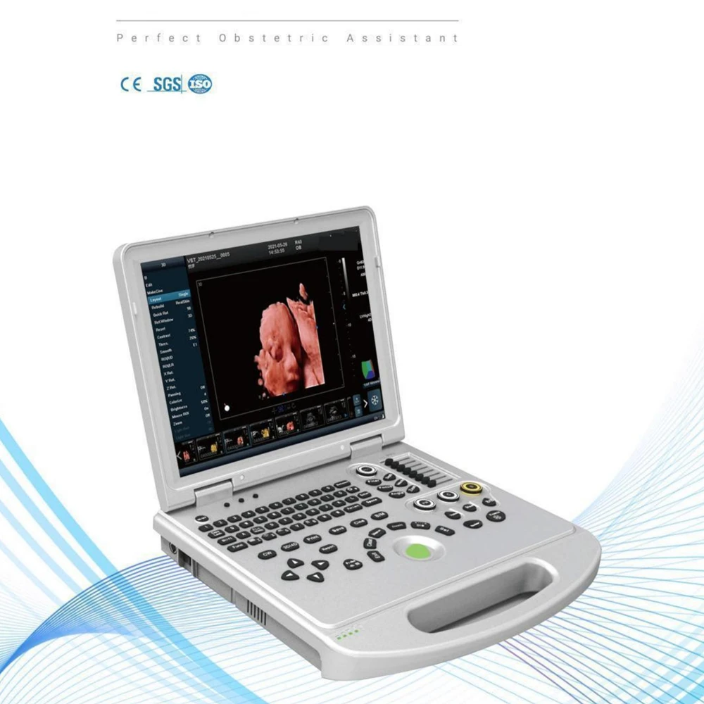 Настоящий 2d 3d 4d Live Echographie цветной доплеровский диагностический портативный