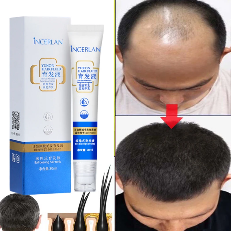 Fast Hair Growth Serum Anti Bald Loss Essence Orginal Natural Scalp Treatment Repair Damaged Hair Roots Beauty Health Hair Care