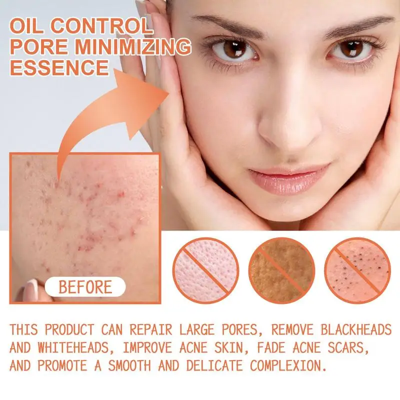 

15 мл, средство для уменьшения пор, сыворотки, контроль жирности, сужение пор, эссенция, уменьшение пор для лица, для сокращения пор, подтяжка кожи, уход за кожей для девочек