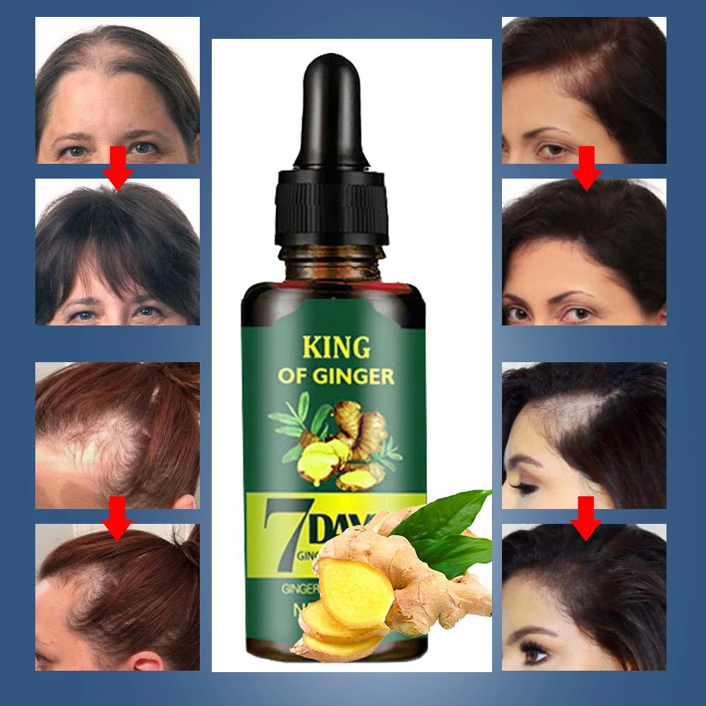 Сыворотка для роста волос Ginger эфирное масло Питательная Жидкость смягчения и